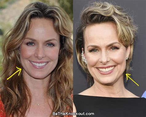 Melora Hardin Plastic Surgery Comparison Photos